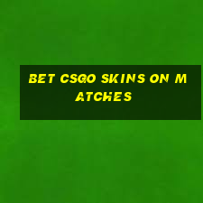 bet csgo skins on matches