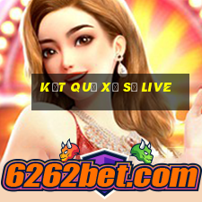 kết quả xổ số live